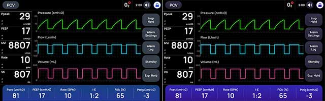 PCV waveform comparison